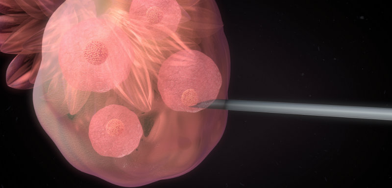 Un risque de dépression après un don d’ovocytes ?! Un risque de dépression après un don d’ovocytes ?!